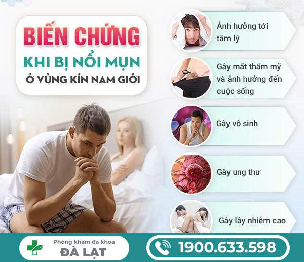 Hình ảnh minh họa